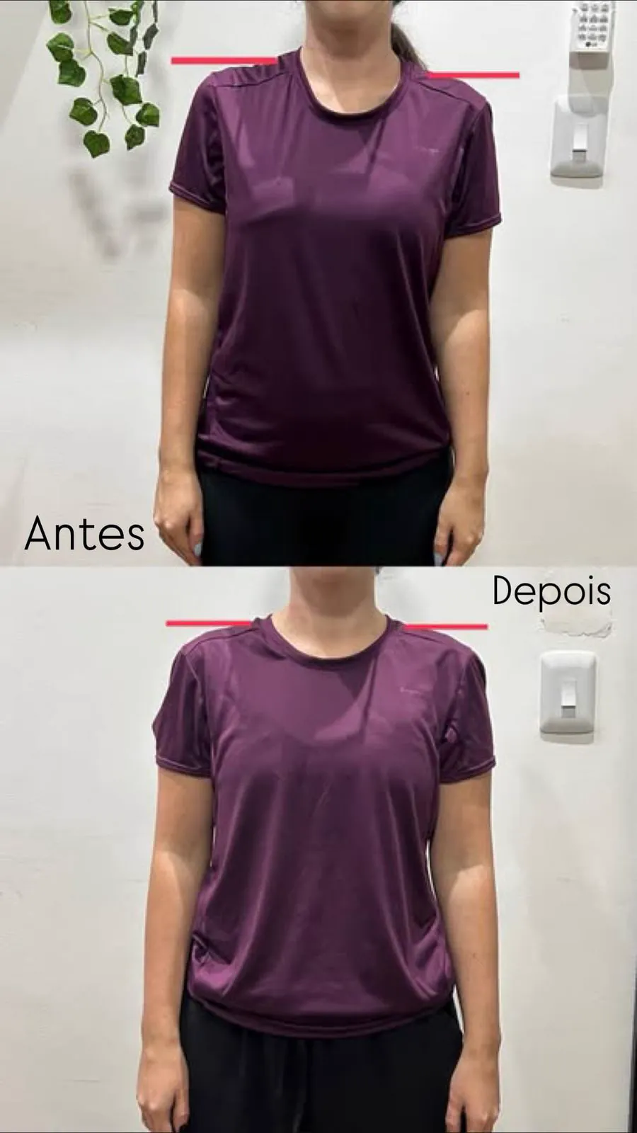 Antes e depois: melhora no alinhamento dos ombros